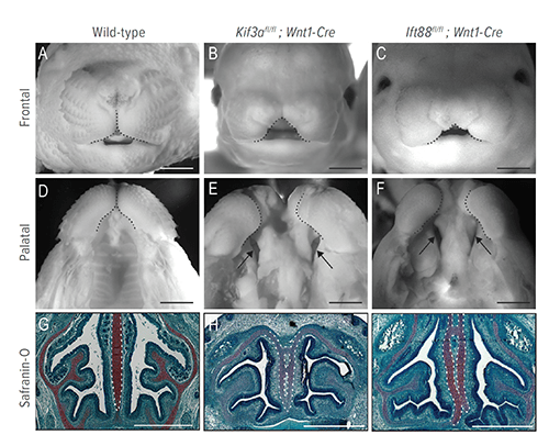 In this figure, images A through C show the frontal view, D through F show the palatal view, and G through I show the transverse sections from e15.5 (A, D, G) wild-type, (B, E, H) Kif3afl/fl;Wnt1-Cre and (C, F, I) Ift88fl/fl;Wnt1-Cre heads. Ciliary mutants (Kif3afl/fl;Wnt1-Cre and Ift88fl/fl) have severe facial widening (B, C; dotted black lines), bilateral cleft of the secondary palate (E, F; black arrows) and duplication of the nasal septum (H, I; dotted white lines).